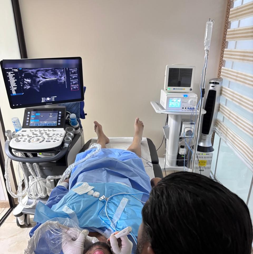 RFA day — the patient awake under local anaesthetic while the needle is guided on ultrasound (shared with written consent)